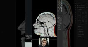 🧠 Blender MRI Visualizer Tool! #blender