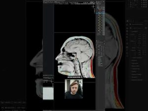 Mri Visualization 🧠 Blender MRI Visualizer Tool! #blender – Blender.fi