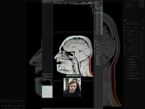 🧠 Blender MRI Visualizer Tool! #blender